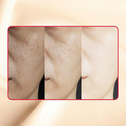 Gymsegbë - Thick As Thieves Pure Glycolic Acid Lactic Acid Extreme Gel Peel - 50ml