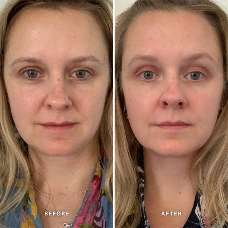 Alpha-H Vitamin A Serum with 0.5% Retinol