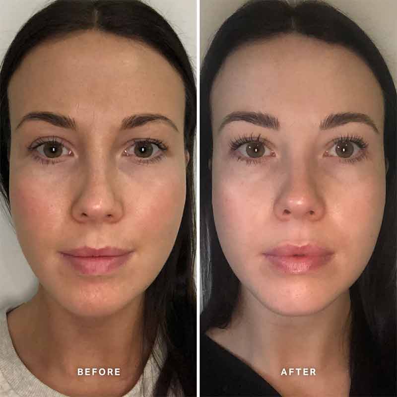 Alpha-H Vitamin B Serum with 5% Niacinamide