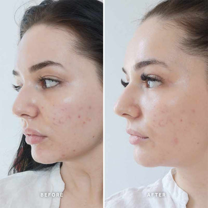 Alpha-H Vitamin B Serum with 5% Niacinamide