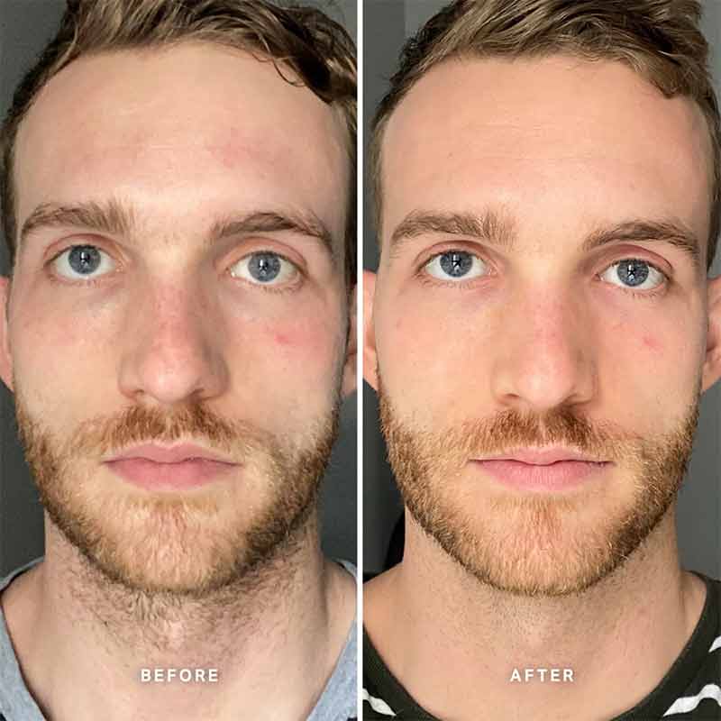 Alpha-H Vitamin B Serum with 5% Niacinamide