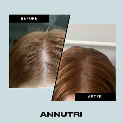 Annutri Grow It Hair Growth Supplement - 6 Month Supply