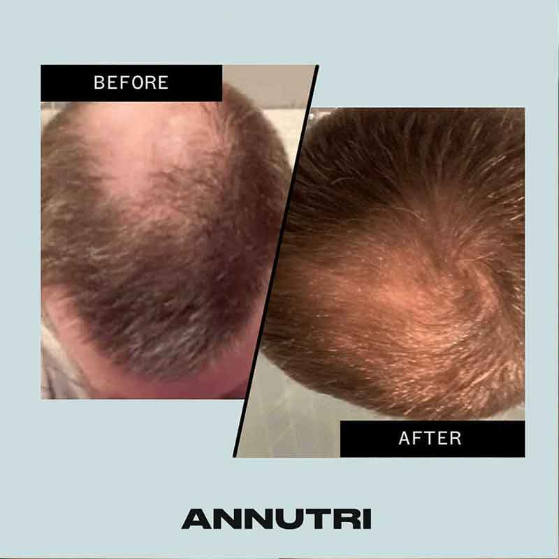 Annutri Grow It Hair Growth Supplement - 6 Month Supply