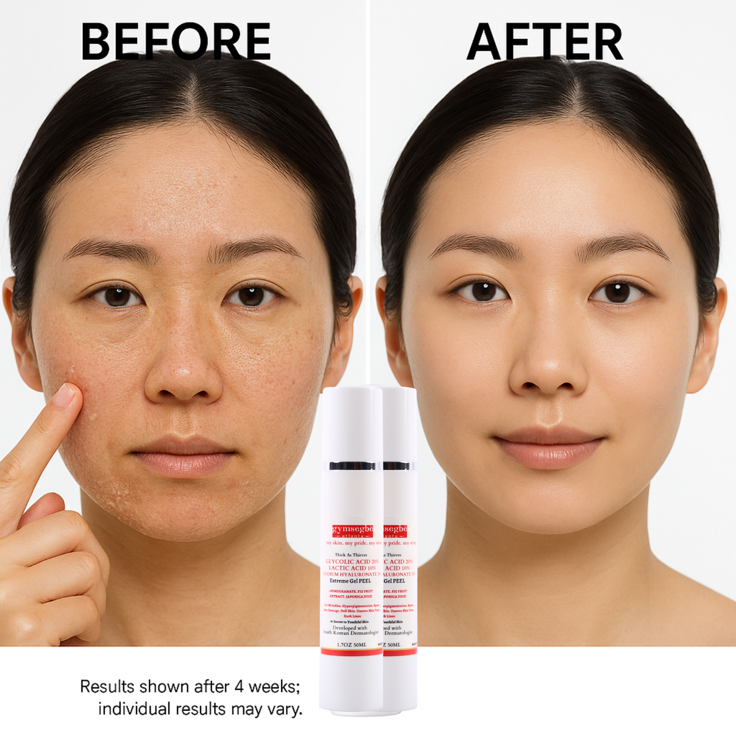 Gymsegbë - Thick As Thieves Pure Glycolic Acid Lactic Acid Extreme Gel Peel - 50ml