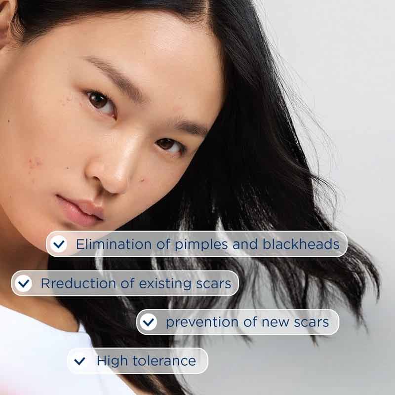 Bioderma Sebium Kerato+ Anti-Blemish High Tolerance Gel-Cream